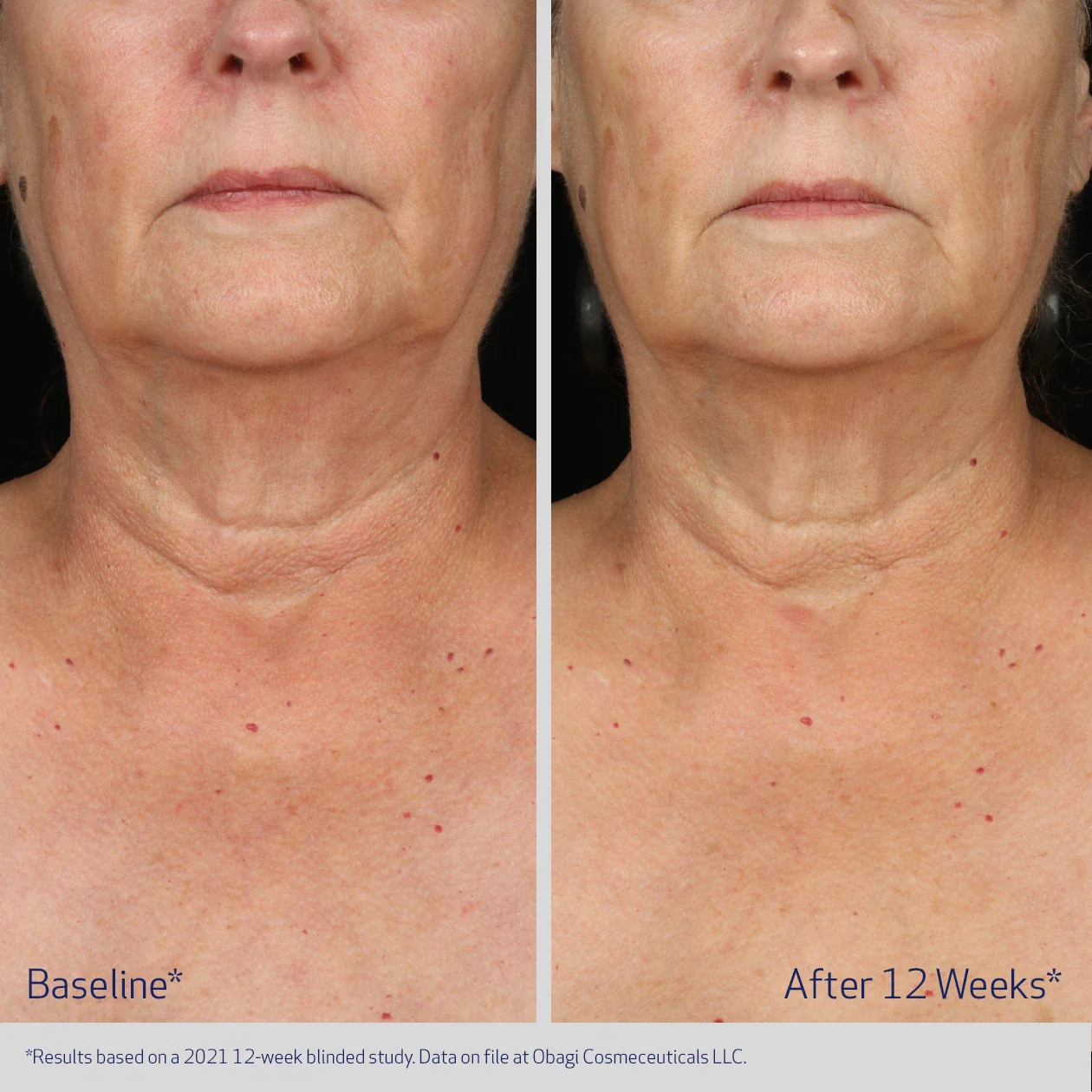 NECK AND DÉCOLLETÉ CONCENTRATE - Image 6