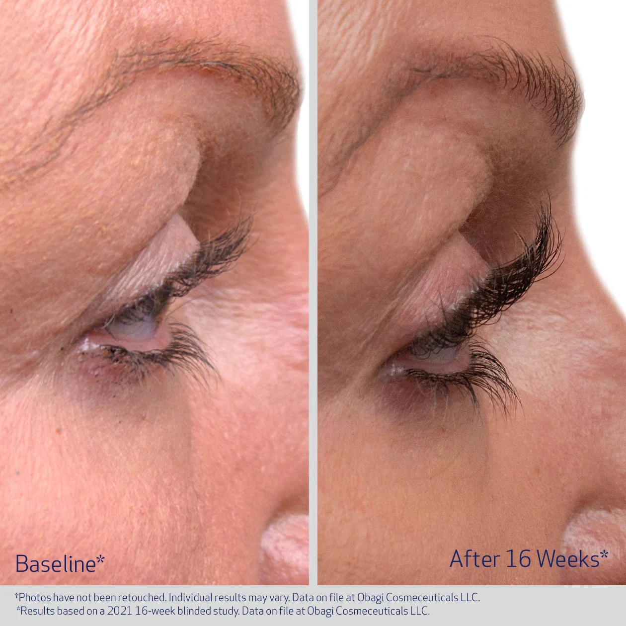 EYELASH ENHANCING SERUM - Image 4