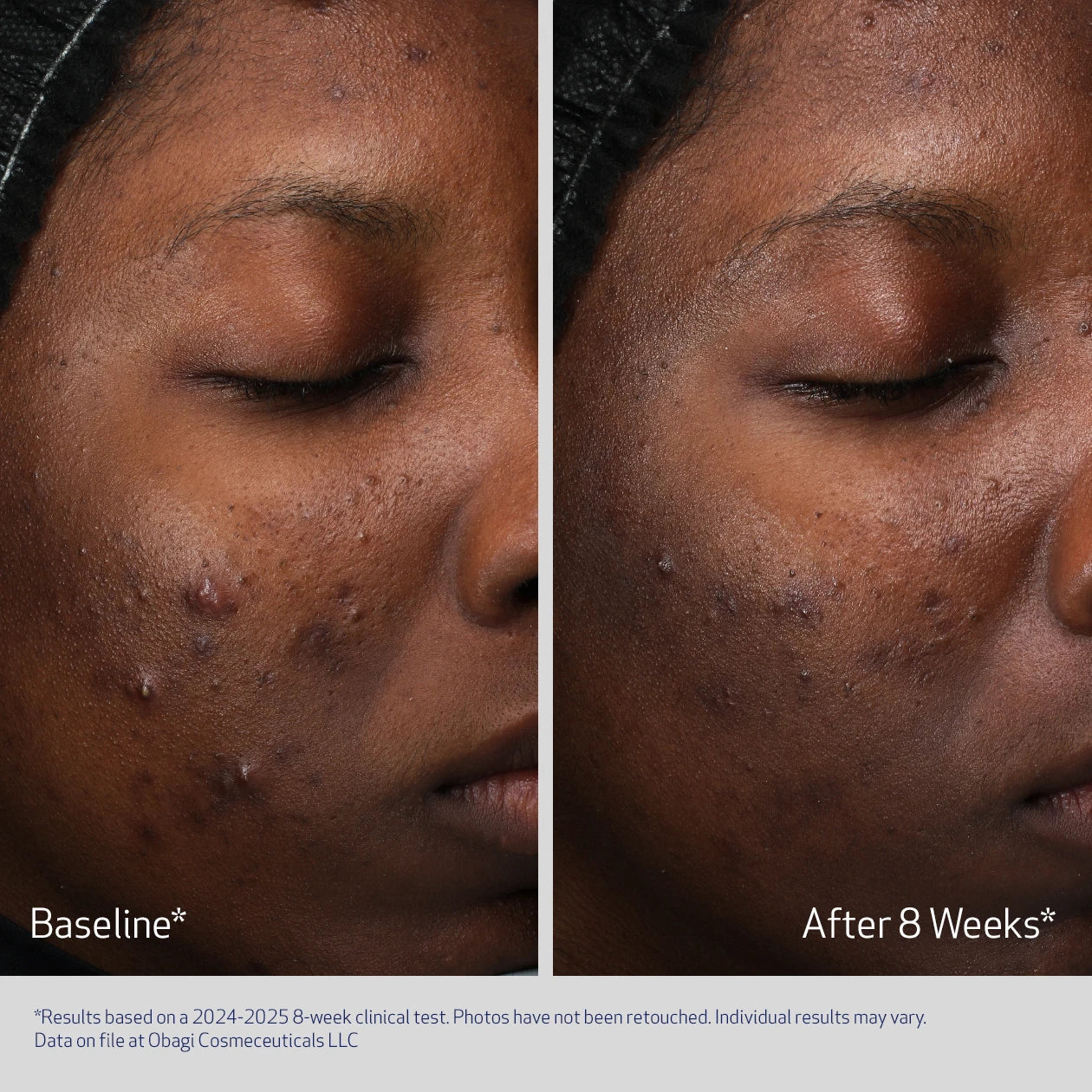 RETINOL + PHA - Image 5