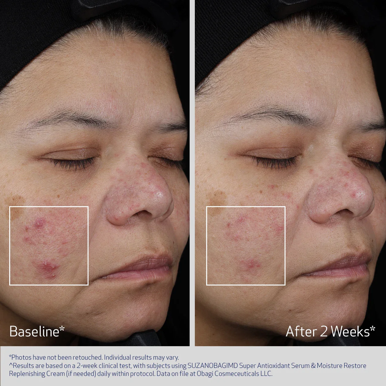 SUPER ANTIOXIDANT SERUM - Image 5
